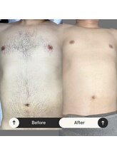 ユーフェム(U-fem)/上半身4回目のお客様