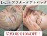 【人気NO.1】◎小顔100分マッサージ付き◎ハーブピーリング[写真OKの方]