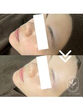 ハルミ美容整体 池袋店(Harumi美容整体)