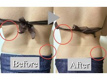 オレンジ(Orange)/2部位/痩身マシンBefore After