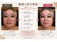 レヴォーテ 練馬(Re-Beaute)の写真