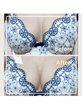 レイビス 盛岡店(RAYVIS)/バストコース☆