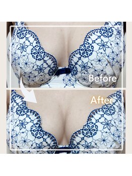 レイビス 盛岡店(RAYVIS)/バストコース☆