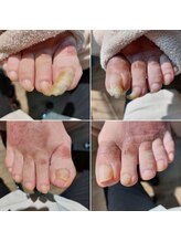 爪切り屋 足楽/切られるのを待っていた