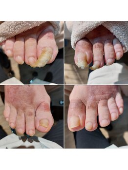 切られるのを待っていた