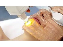 メディカルサロン フィオレ(fiore)/ 【Drライトフェイシャル】