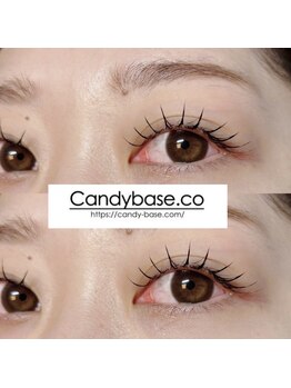 キャンディベース ノースアップ(Candybase North up)/まつ毛エクステ