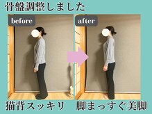 シェノン(Chainon)/骨盤調整