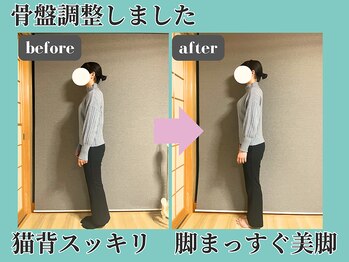 シェノン(Chainon)/骨盤調整