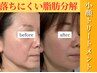 New【韓国発レモンボトル☆小顔脂肪分解＋燃焼】×プラズマ導入１部位２cc