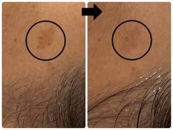 エフェクト 塚口店(effect)/Before After 50代/7回目