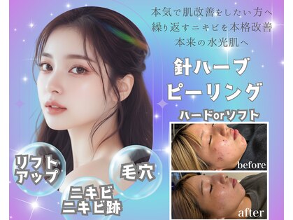 シード(SHE°)の写真