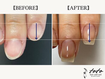 toto hair and nail【自爪育成・ネイルケア】/【toto式】自爪育成