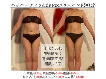 メイリー(MEILLI)/まだ諦めてほしくない！