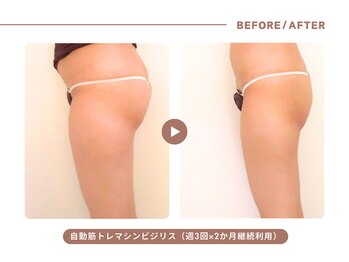 イエス マイサロン(yes My Salon)/自動筋トレマシンBIJIRIS施術例