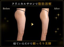 リオ(Rio)/【痩身/足/脂肪燃焼10ml】