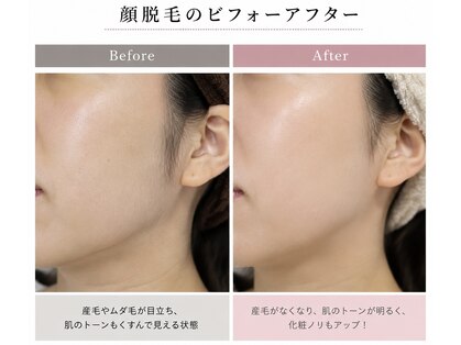 エヌアール(NR)の写真