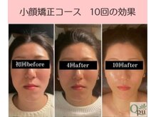 キュープ 京都店(Qpu)の雰囲気(積み重ねたケアが、未来の小顔を作ります。)