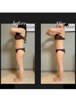 エヌボーテ(N. beaute)/before→after全身コース4回目