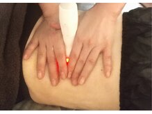 オスマンティエ(Osmantier)/痩身