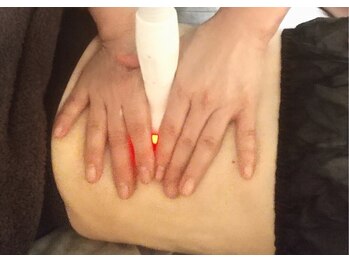 オスマンティエ(Osmantier)/痩身