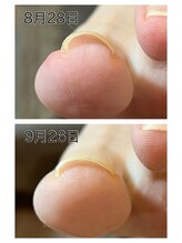 キャンディベース フクシマ(Candybase Fukushima)/一度の施術でこの効果！