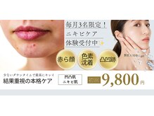 チュラ(Chura)