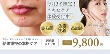 チュラ(Chura)