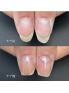 ハンドケア・自爪育成・深爪育成