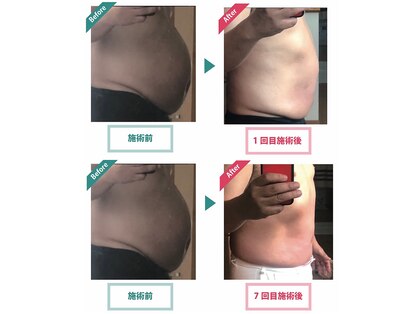 レニフォーメン(reni for men)の写真