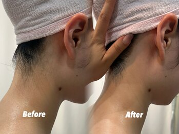 クイーン 渋谷店(QUEEN)/産毛の状態でも