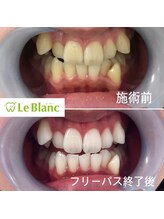 ルブラン 奈良店(Le Blanc)/納得の白さに！