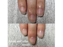 ナナラ(nanala)の雰囲気（＜自爪育成＞チビ爪、貝爪、噛み爪、爪のピンク部分伸ばしたい方）