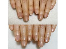 エマネイル(emma nail)/気になる爪の縦じわも！！