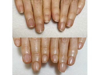 エマネイル(emma nail)/気になる爪の縦じわも！！