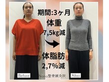 ナナ整骨鍼灸院 ココ(Nana整骨鍼灸院 Coco)の雰囲気（整体、全身痩身で見た目から綺麗に◎国家資格者在籍）