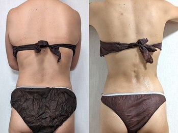 ネイル リリ(nail RiRi)/3ヶ月マイナス6kg！