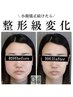 ★オープン4ヶ月記念クーポン★小顔矯正+オイル+美肌美顔器￥21,900→￥8,800