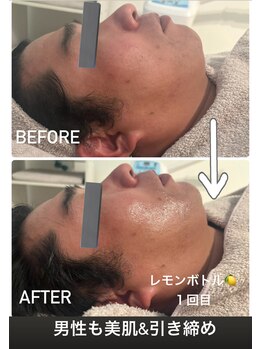 カエラ(KAELA)/レモンボトル