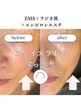 ユヌランコント 岐阜店(Une rencontre)/EMS×ラジオ波×エンビロン