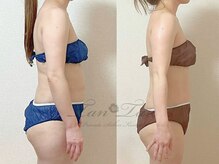 プライベートサロン タンタン(tantan)/短期集中ケア　40代女性