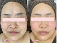 ミレット(Miretto)/ジョジアンロール【ファシア】