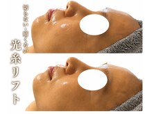 メイリリー(Maylilly)の雰囲気（光・糸リフトハリ・弾力・毛穴収縮・小顔・シワ改善）