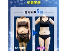 サロンウヌ(Salon uNu)の雰囲気（継続したこその結果です）