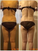 ビューティーワークスシャンティ 柏店(Beauty Works Shanti)/お客様の痩身結果☆