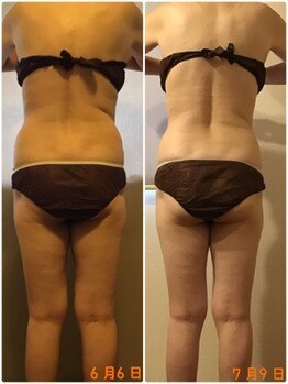 ビューティーワークスシャンティ 柏店(Beauty Works Shanti)/お客様の痩身結果☆