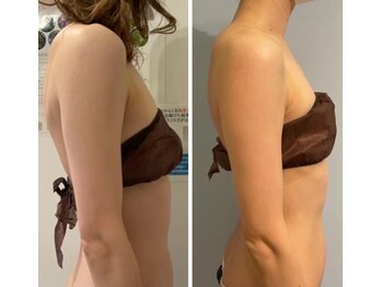 ルナグランデ(Luna grande.)/姿勢も良くなって脂肪も撃退