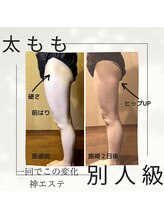 アクアリジェ/筋膜リリース+痩身マシン1回