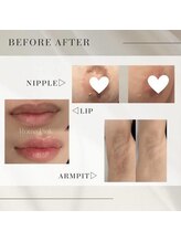 オリ('OLI)/ローマピンク