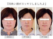 エピファニー(Epiphany)/50代　頭痛・首肩こり、不眠